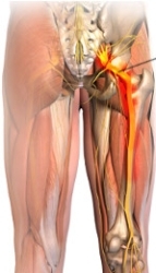 Sciatic Nerve For Sciatica Massage In York