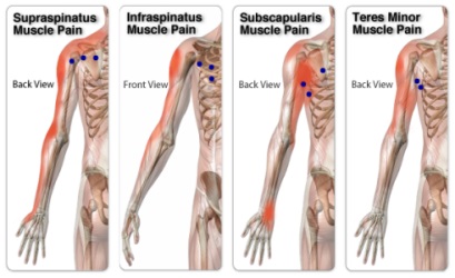 Types Of Rotator Cuff Shoulder Pain Massage In York