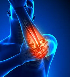 Tennis Elbow Golfers Elbow Pain