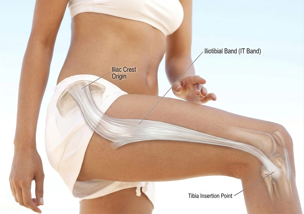 Structural diagram of the IT band running from the hip crest to the knee, illustrating the lateral thigh structure responsible for pelvic misalignment and compensatory lower back pain.