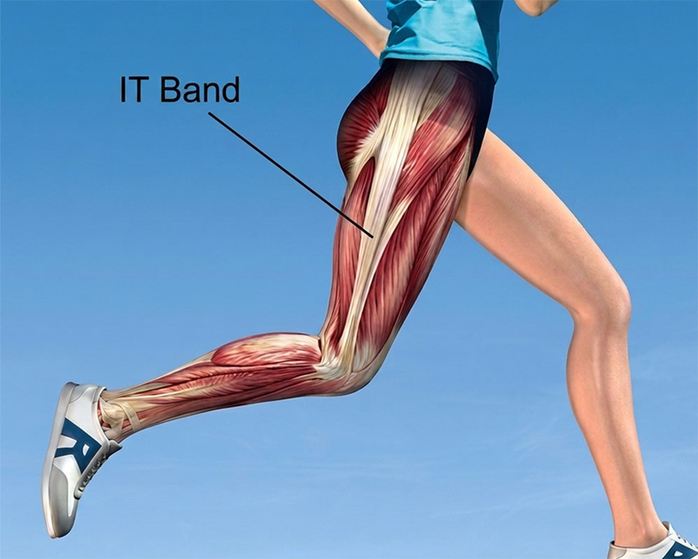 IT Band anatomy An anatomical diagram of a runner showing a muscular overlay of the leg with a text label pointing to the IT Band, illustrating lateral knee pain issues treated with mobile sports massage in York.