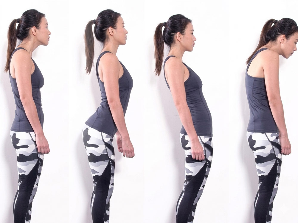 Four side-profile diagrams showing different posture types including forward head posture, anterior pelvic tilt, swayback, and rounded shoulders.